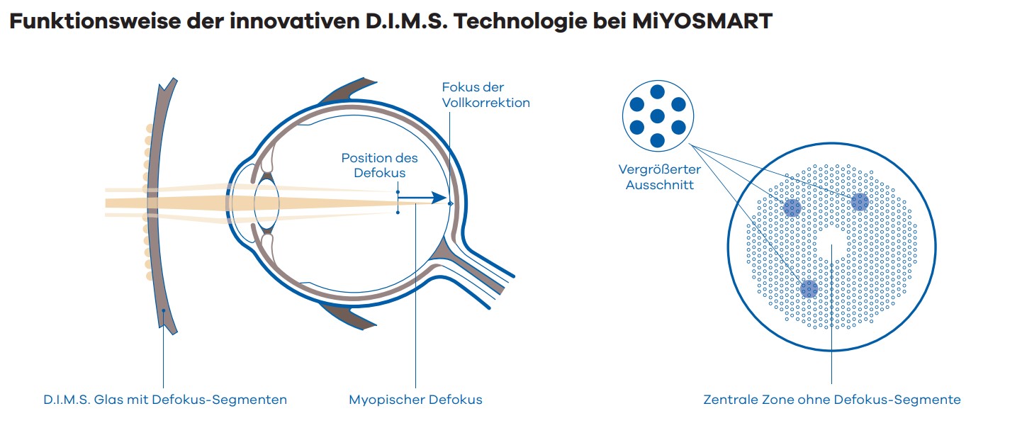Myopie Management Optik & Optometrie Schreiner in Göttingen